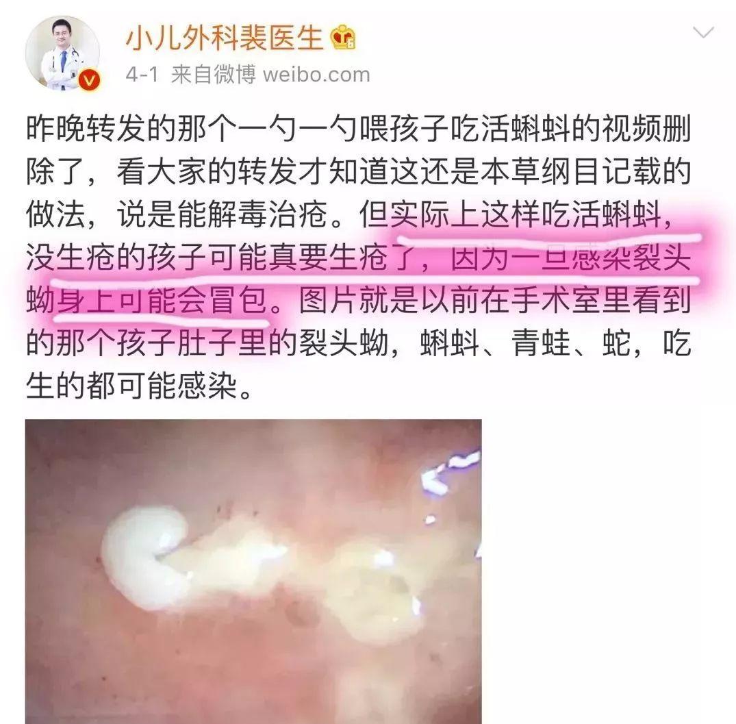 ”嘴里倒开水”，”肚皮扎针”，“活吞小蝌蚪”....脑残爹妈和娃这是多大的仇？