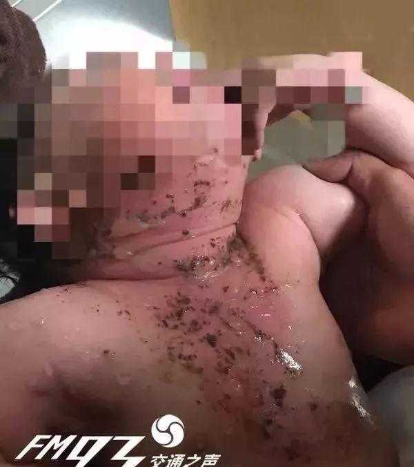 ”嘴里倒开水”，”肚皮扎针”，“活吞小蝌蚪”....脑残爹妈和娃这是多大的仇？