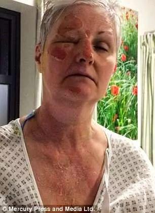 学美食博客用微波炉做糖心蛋,这位妈妈差点毁容.... 学美食博客用微波炉做糖心蛋,这位妈妈差点毁容....