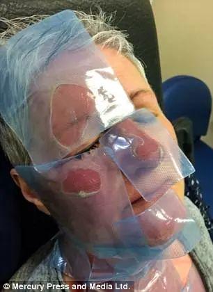 学美食博客用微波炉做糖心蛋,这位妈妈差点毁容.... 学美食博客用微波炉做糖心蛋,这位妈妈差点毁容....