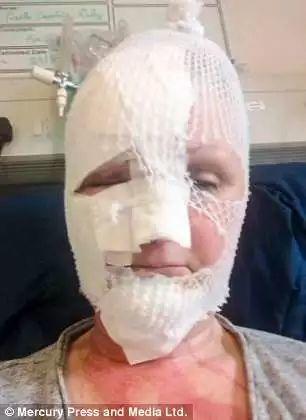 学美食博客用微波炉做糖心蛋,这位妈妈差点毁容.... 学美食博客用微波炉做糖心蛋,这位妈妈差点毁容....