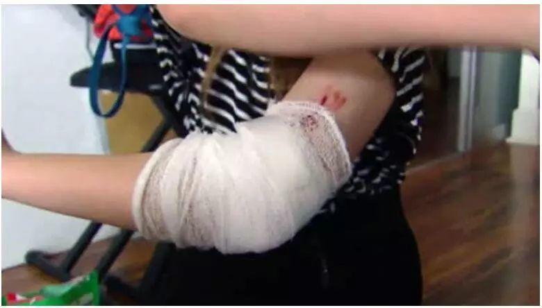 北约克公园恶狗咬伤12岁女孩咬死小狗，多伦多夏季遛狗遛娃守则！