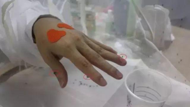 人肉测试：喂了500只蚊子，确认了这些防蚊产品才是你和娃需要的