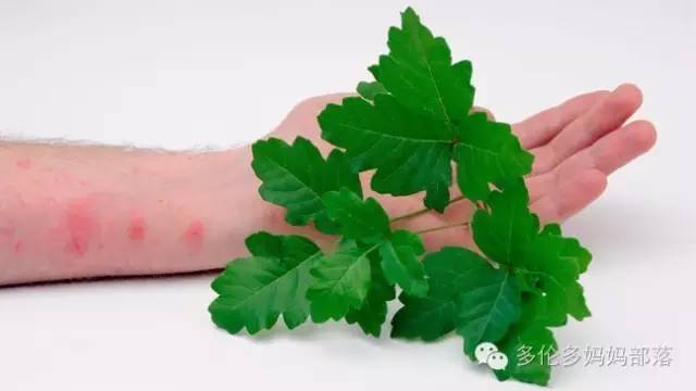 夏天来了，这些花花草草不要碰！因为有！巨！毒！