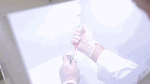 “妈妈手”，“产后腰酸背痛”，你还在忍痛吗？