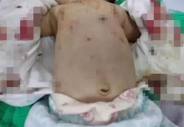 扒一扒婆婆妈妈七姑八姨的迷信偏方：这都是什么鬼？！