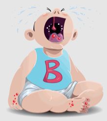 【傻傻分不清】玫瑰疹、手足口、疱疹,一篇搞定夏季“红点”症! 【傻傻分不清】玫瑰疹、手足口、疱疹,一篇搞定夏季“红点”症!