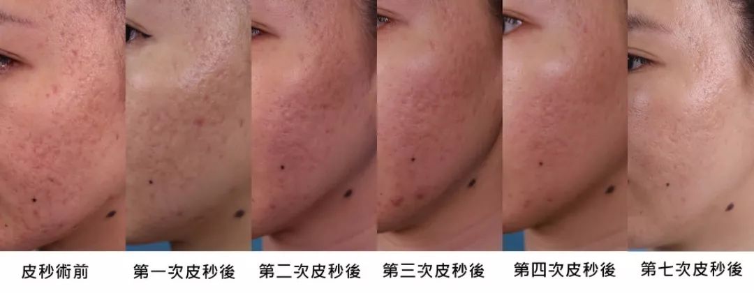 单亲妈妈整装待发,“缺的不是男人,是自信” 单亲妈妈整装待发,“缺的不是男人,是自信”