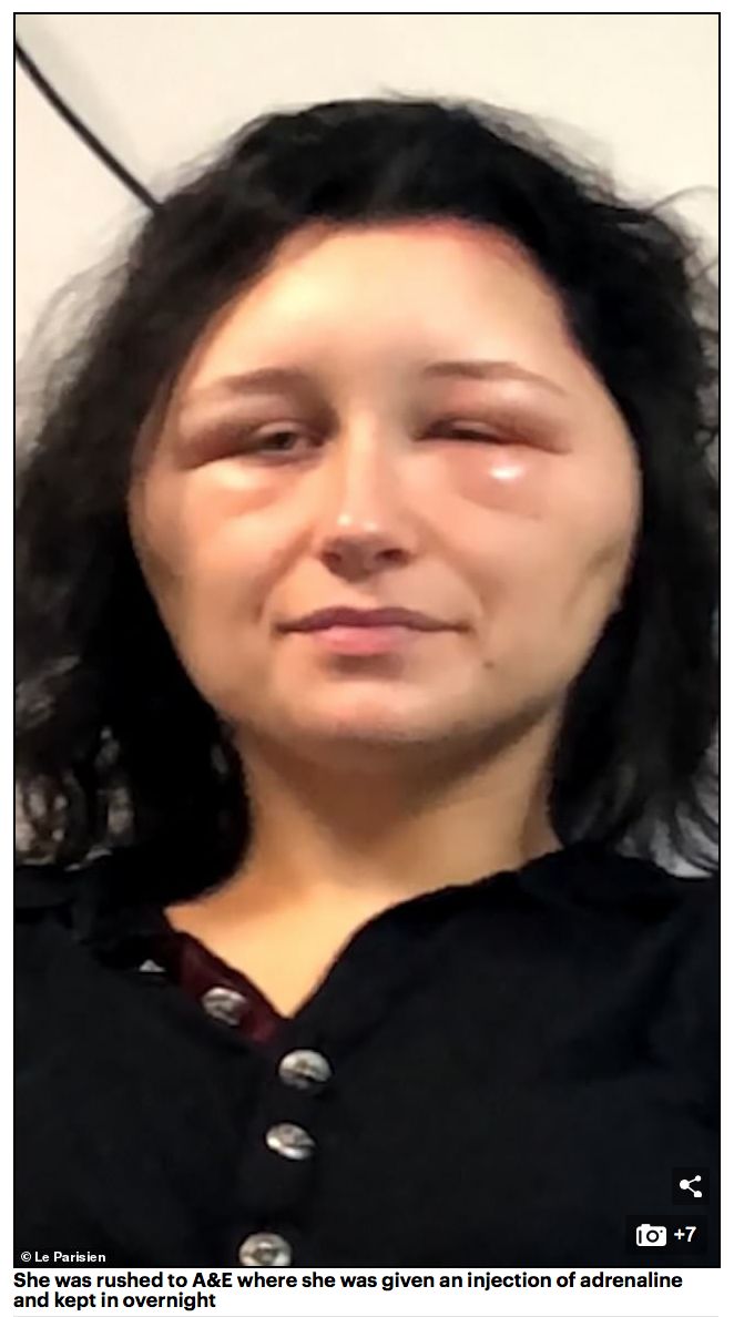 妹子自己在家染发,脑袋肿成了外星人..... 妹子自己在家染发,脑袋肿成了外星人.....