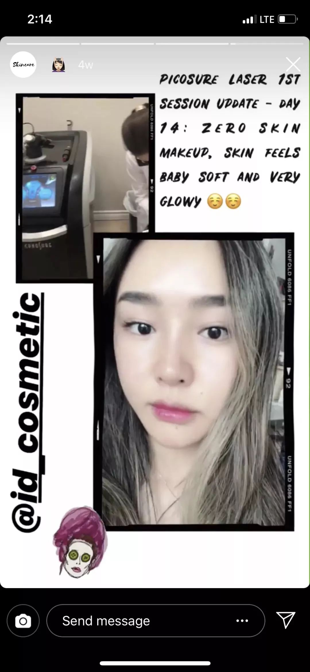 打玻尿酸=整容？听听加拿大医生怎么说...