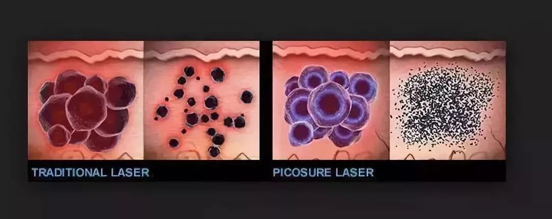 打玻尿酸=整容？听听加拿大医生怎么说...