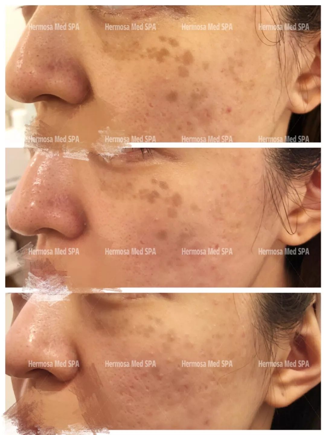 VOUGE话题:月花2000买护肤品vs日用大宝做医美,选哪个? VOUGE话题:月花2000买护肤品vs日用大宝做医美,选哪个?