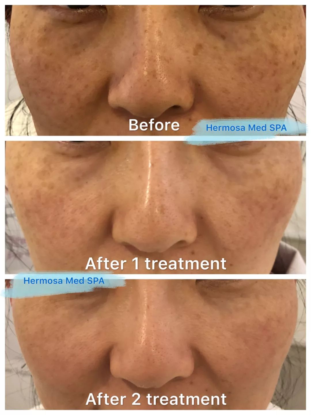 VOUGE话题:月花2000买护肤品vs日用大宝做医美,选哪个? VOUGE话题:月花2000买护肤品vs日用大宝做医美,选哪个?