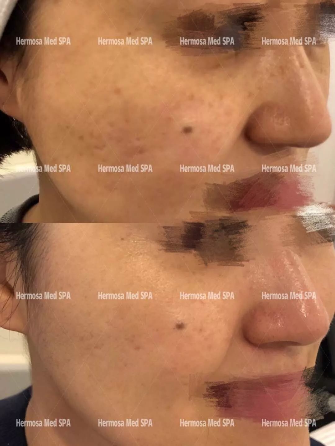 VOUGE话题:月花2000买护肤品vs日用大宝做医美,选哪个? VOUGE话题:月花2000买护肤品vs日用大宝做医美,选哪个?