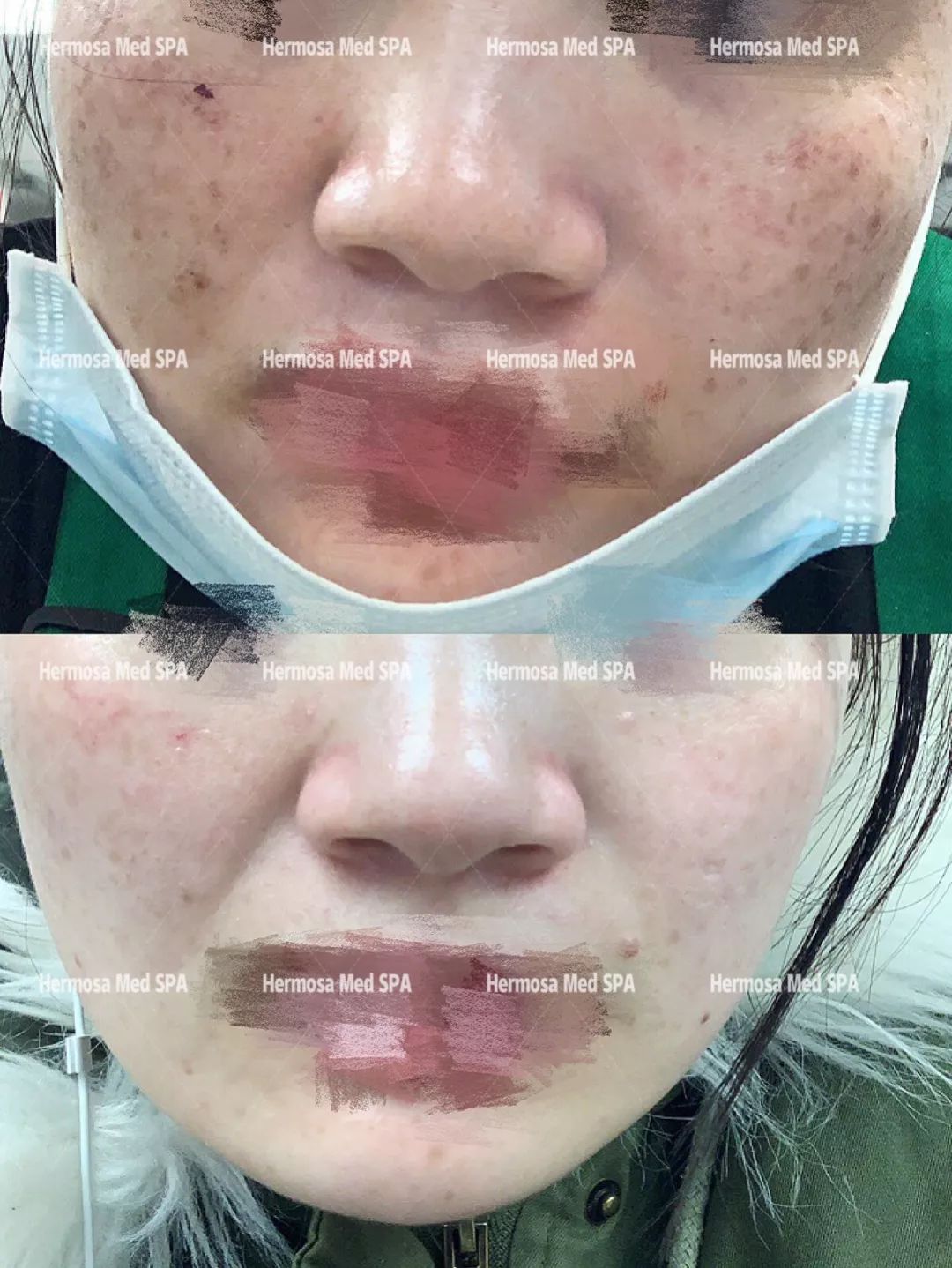 VOUGE话题:月花2000买护肤品vs日用大宝做医美,选哪个? VOUGE话题:月花2000买护肤品vs日用大宝做医美,选哪个?