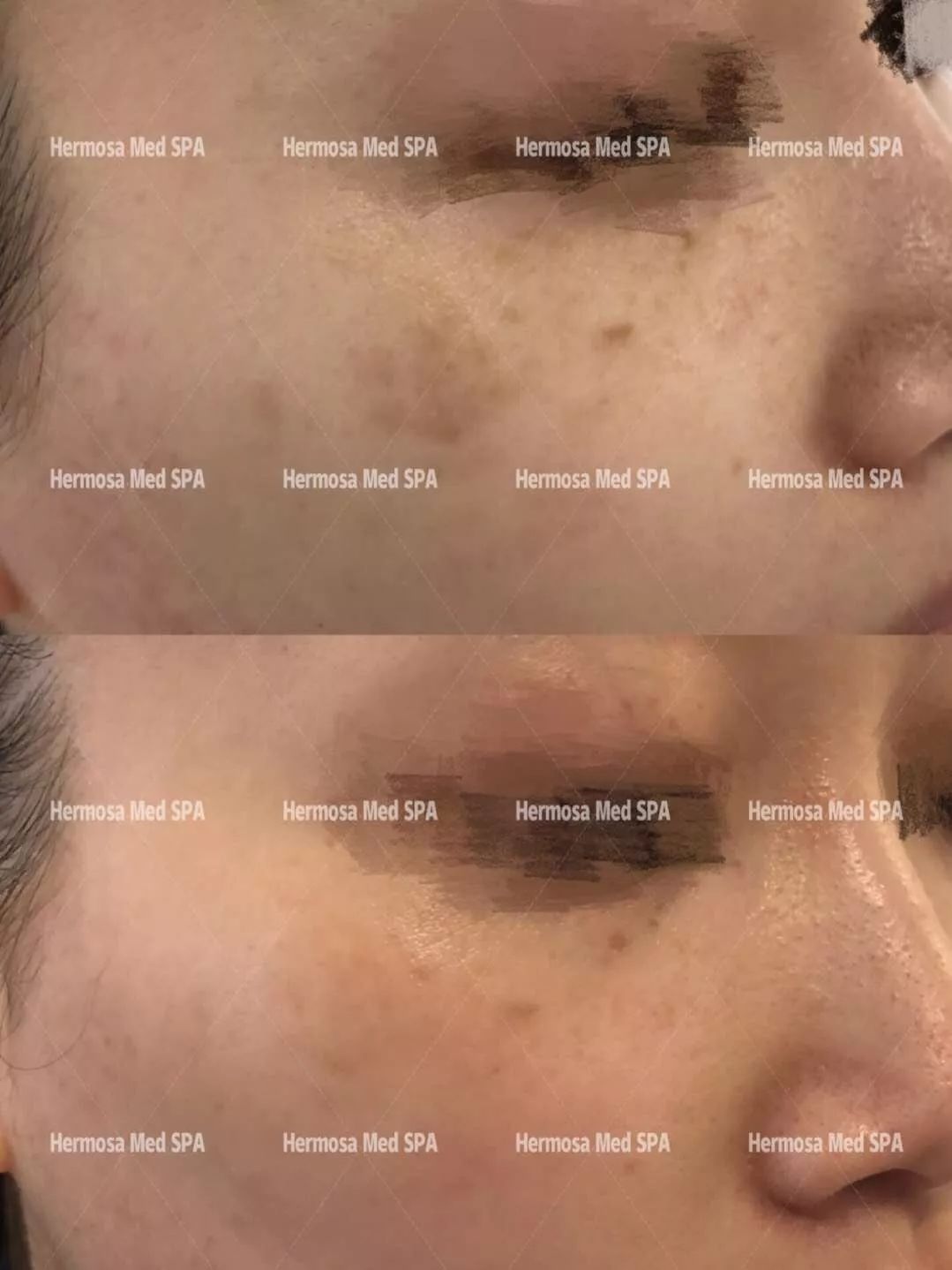 VOUGE话题:月花2000买护肤品vs日用大宝做医美,选哪个? VOUGE话题:月花2000买护肤品vs日用大宝做医美,选哪个?