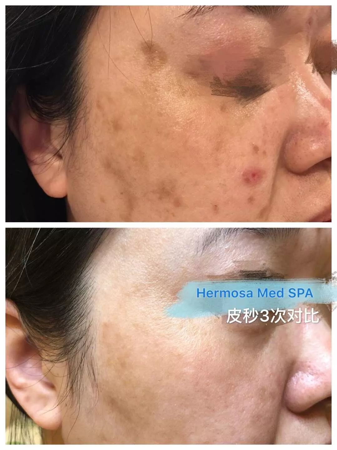 VOUGE话题:月花2000买护肤品vs日用大宝做医美,选哪个? VOUGE话题:月花2000买护肤品vs日用大宝做医美,选哪个?