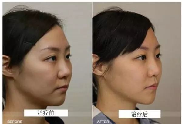 VOUGE话题:月花2000买护肤品vs日用大宝做医美,选哪个? VOUGE话题:月花2000买护肤品vs日用大宝做医美,选哪个?