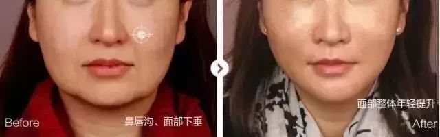 VOUGE话题:月花2000买护肤品vs日用大宝做医美,选哪个? VOUGE话题:月花2000买护肤品vs日用大宝做医美,选哪个?