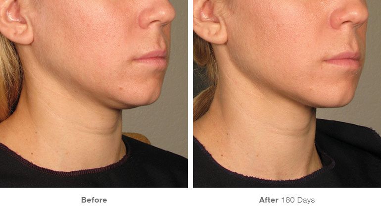 VOUGE话题:月花2000买护肤品vs日用大宝做医美,选哪个? VOUGE话题:月花2000买护肤品vs日用大宝做医美,选哪个?