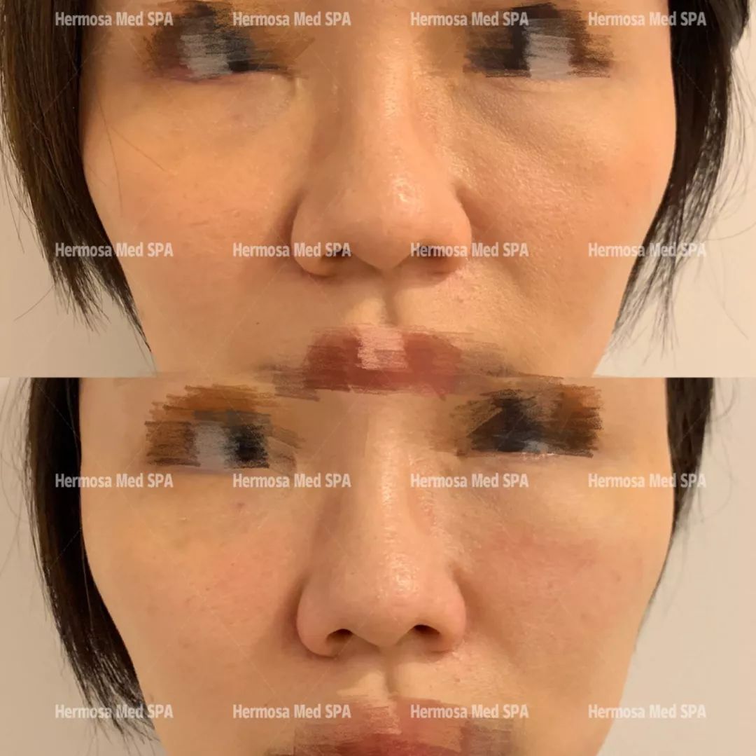 VOUGE话题:月花2000买护肤品vs日用大宝做医美,选哪个? VOUGE话题:月花2000买护肤品vs日用大宝做医美,选哪个?