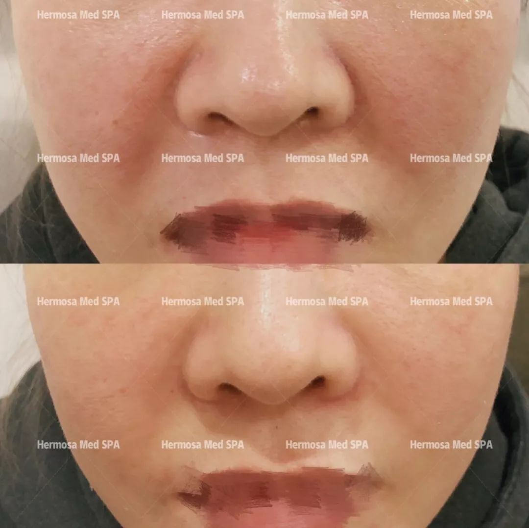 VOUGE话题:月花2000买护肤品vs日用大宝做医美,选哪个? VOUGE话题:月花2000买护肤品vs日用大宝做医美,选哪个?