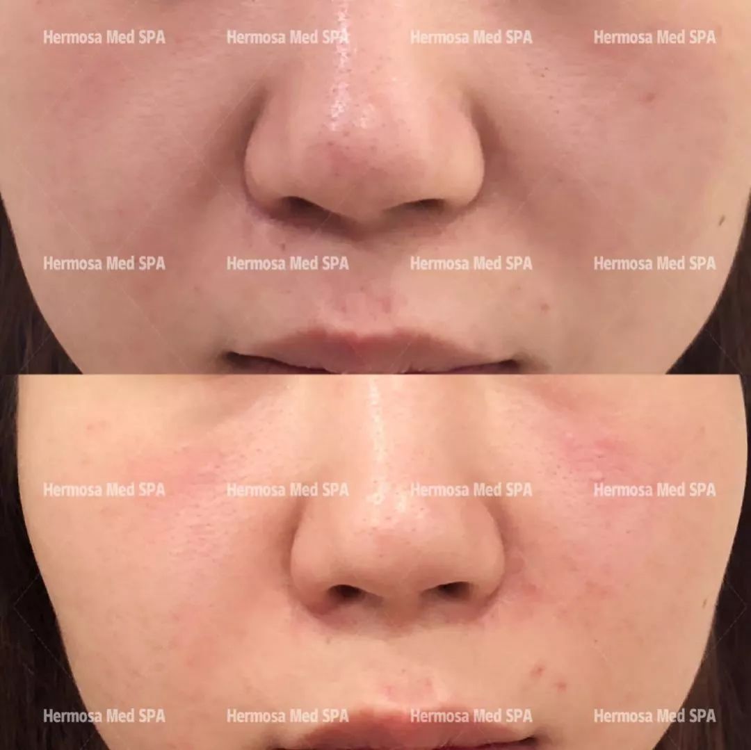 VOUGE话题:月花2000买护肤品vs日用大宝做医美,选哪个? VOUGE话题:月花2000买护肤品vs日用大宝做医美,选哪个?