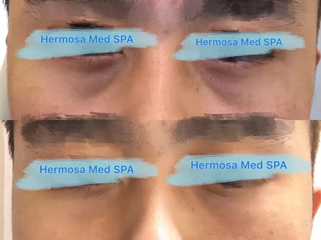 VOUGE话题:月花2000买护肤品vs日用大宝做医美,选哪个? VOUGE话题:月花2000买护肤品vs日用大宝做医美,选哪个?