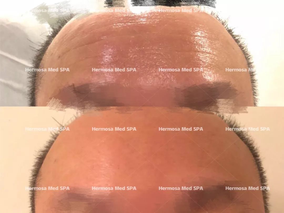 VOUGE话题:月花2000买护肤品vs日用大宝做医美,选哪个? VOUGE话题:月花2000买护肤品vs日用大宝做医美,选哪个?