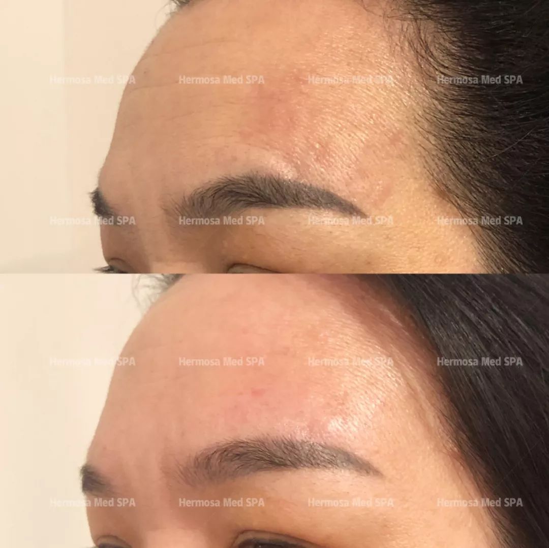 VOUGE话题:月花2000买护肤品vs日用大宝做医美,选哪个? VOUGE话题:月花2000买护肤品vs日用大宝做医美,选哪个?