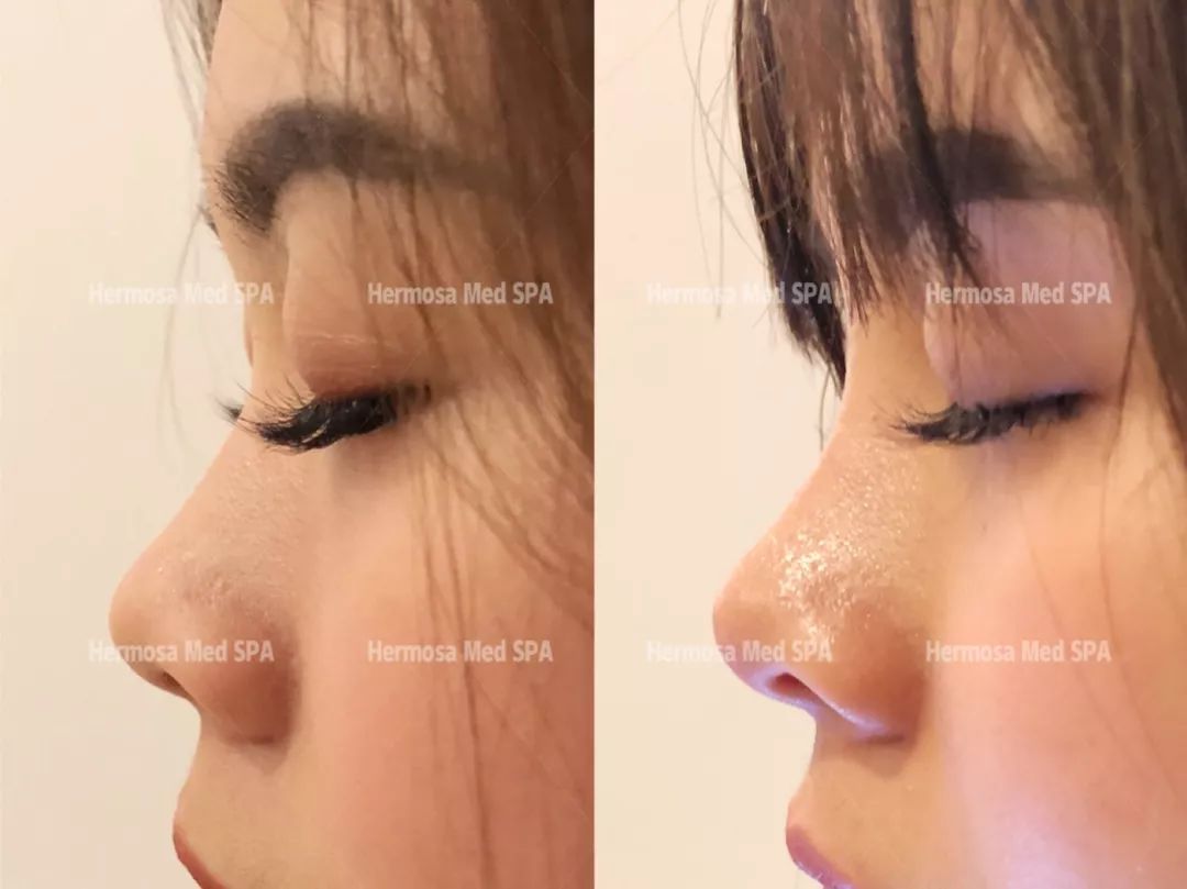 VOUGE话题:月花2000买护肤品vs日用大宝做医美,选哪个? VOUGE话题:月花2000买护肤品vs日用大宝做医美,选哪个?