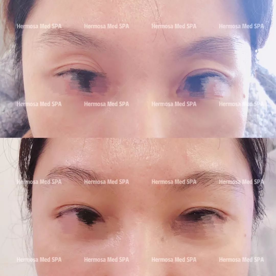 VOUGE话题:月花2000买护肤品vs日用大宝做医美,选哪个? VOUGE话题:月花2000买护肤品vs日用大宝做医美,选哪个?