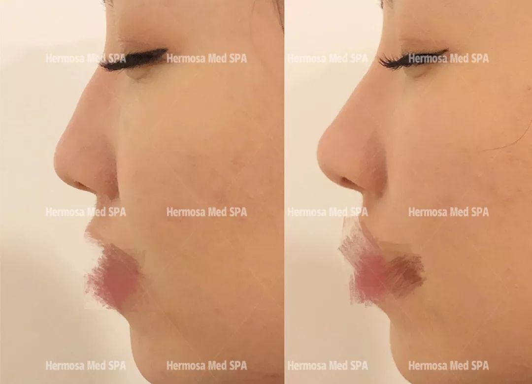 VOUGE话题:月花2000买护肤品vs日用大宝做医美,选哪个? VOUGE话题:月花2000买护肤品vs日用大宝做医美,选哪个?