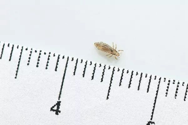 又闹虱子！还是变异的！长过虱子的娃更容易被传染！！