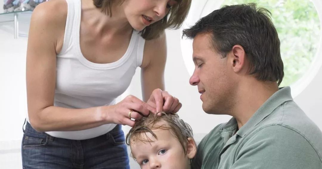 又闹虱子！还是变异的！长过虱子的娃更容易被传染！！