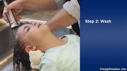 又闹虱子！还是变异的！长过虱子的娃更容易被传染！！