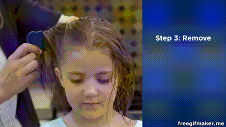 又闹虱子！还是变异的！长过虱子的娃更容易被传染！！