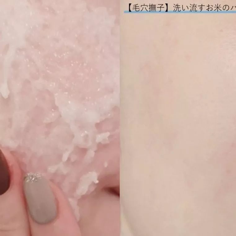 秒杀BUG价!全加最大日韩面膜节终于又到了,全编辑室都沸腾了…… 秒杀BUG价!全加最大日韩面膜节终于又到了,全编辑室都沸腾了……