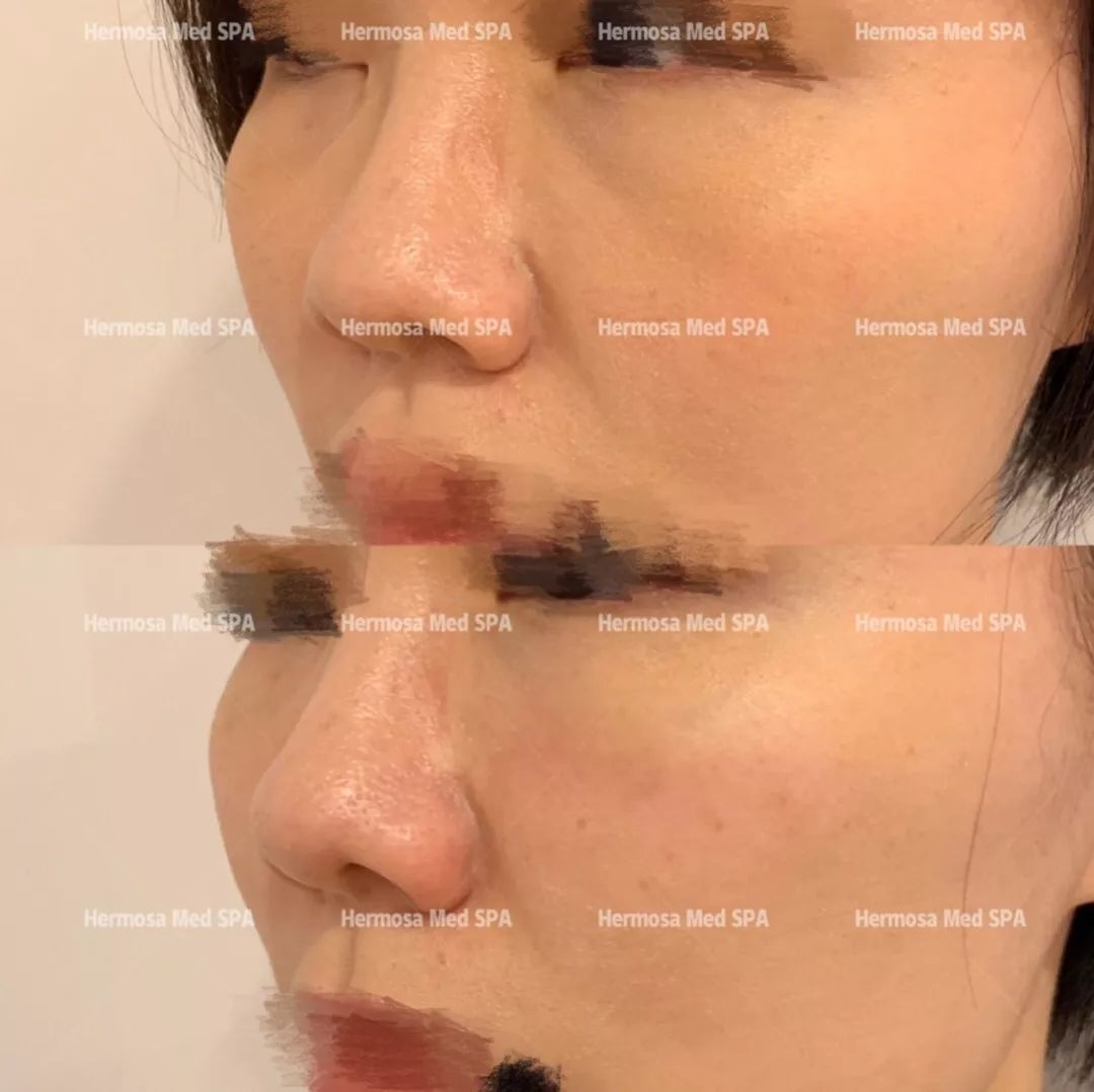 看完这些before和after,不心动太难了.... 看完这些before和after,不心动太难了....