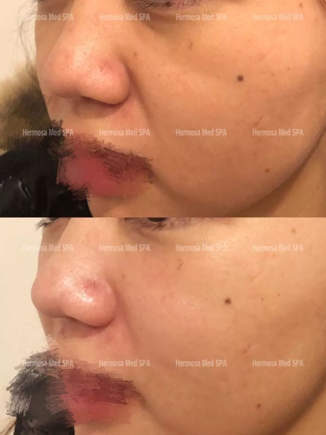 看完这些before和after,不心动太难了.... 看完这些before和after,不心动太难了....
