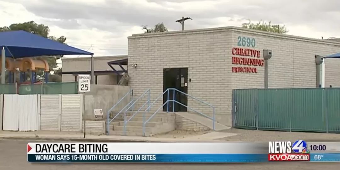 娃上Daycare竟然被人咬了25次,后背全是牙印... 娃上Daycare竟然被人咬了25次,后背全是牙印...