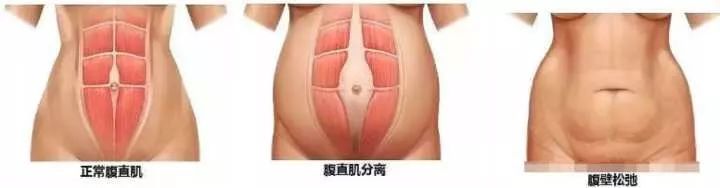 产后修复瘦身竟然不用管住嘴还不反弹?!这些多伦多妈妈们亲身告诉你 产后修复瘦身竟然不用管住嘴还不反弹?!这些多伦多妈妈们亲身告诉你