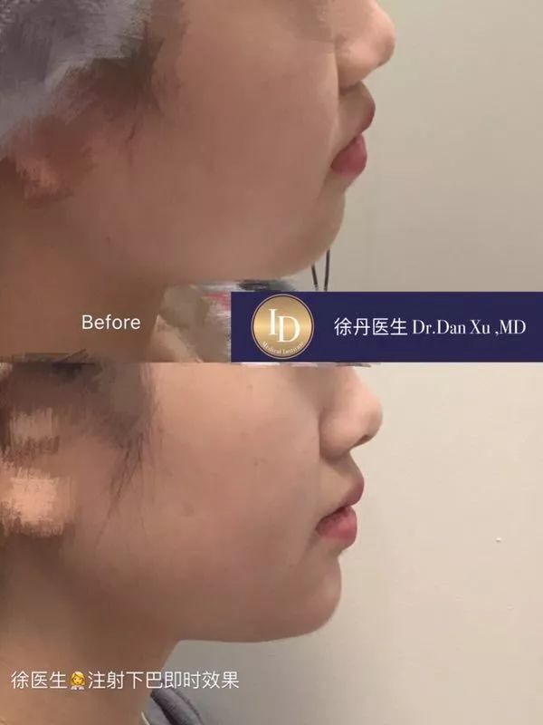 当妈妈不能就这么算了!买包和变美,我选这个... 当妈妈不能就这么算了!买包和变美,我选这个...