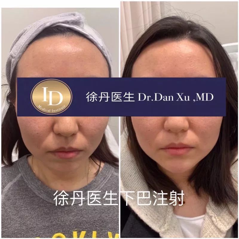 当妈妈不能就这么算了!买包和变美,我选这个... 当妈妈不能就这么算了!买包和变美,我选这个...