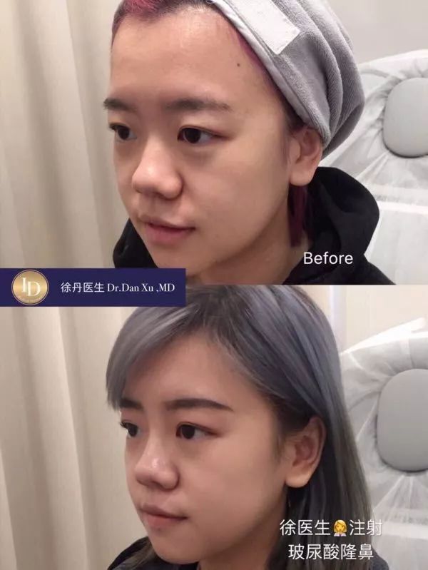 当妈妈不能就这么算了!买包和变美,我选这个... 当妈妈不能就这么算了!买包和变美,我选这个...