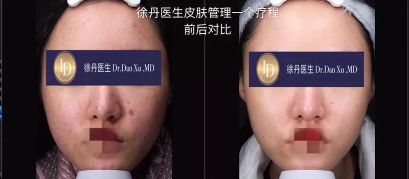 名人博主御用医美：美的万里挑一，绝不千篇一律
