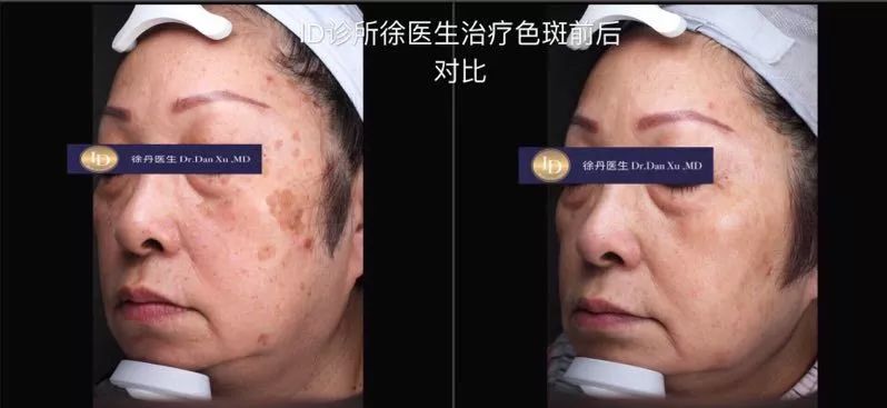 名人博主御用医美：美的万里挑一，绝不千篇一律
