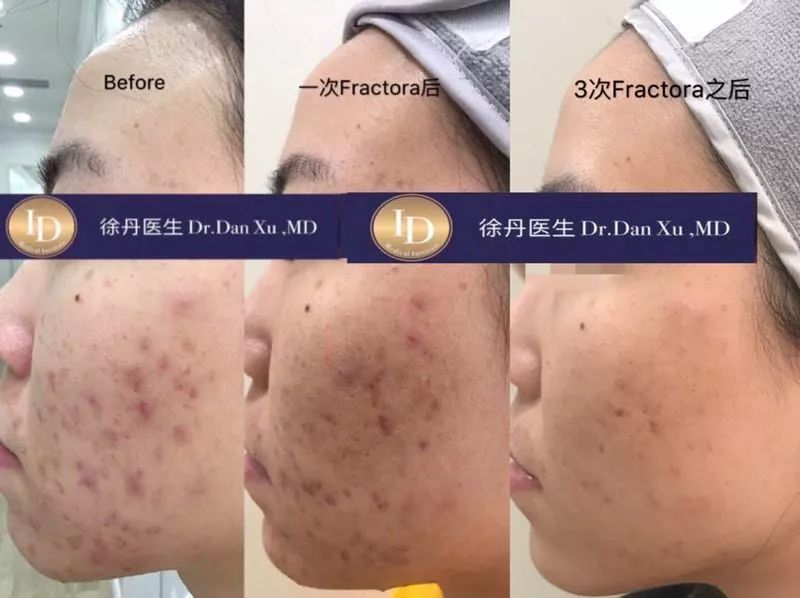 名人博主御用医美：美的万里挑一，绝不千篇一律