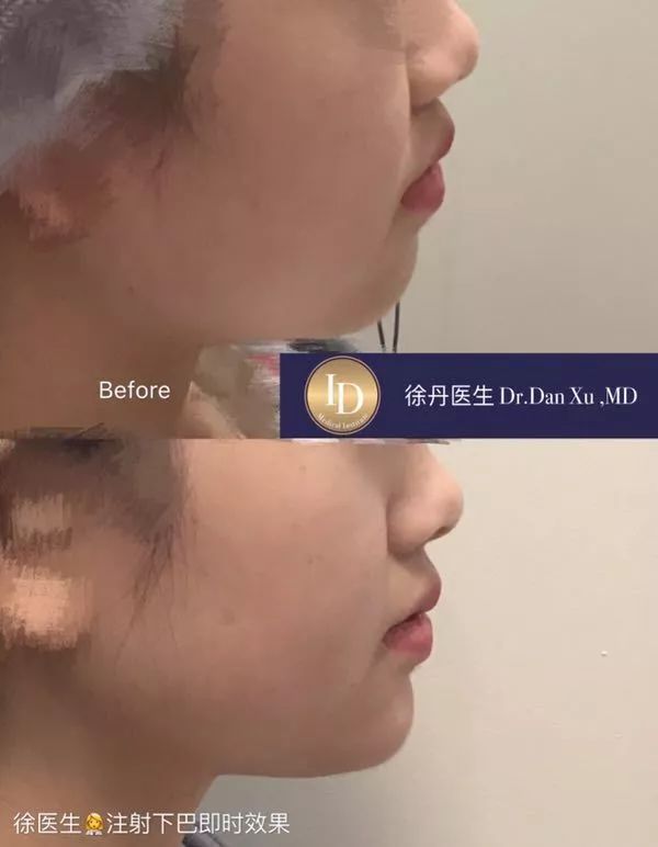 名人博主御用医美：美的万里挑一，绝不千篇一律