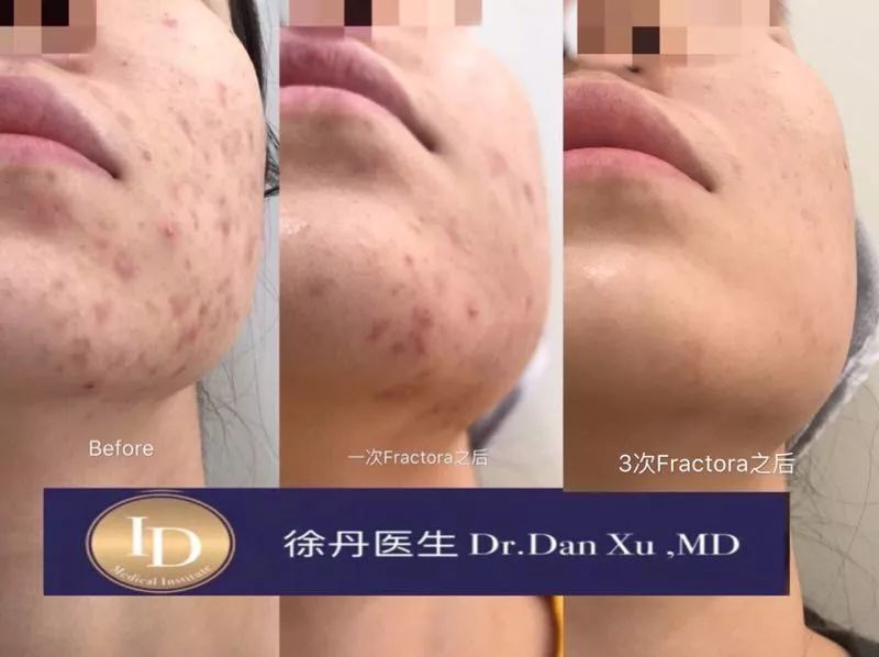 名人博主御用医美：美的万里挑一，绝不千篇一律